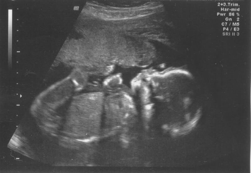 22WeekScan.jpg