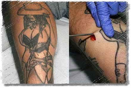 TATTOO BREAST IMPLANTS 2 Pictures, Images and Photos